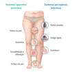 Sintomas do linfedema