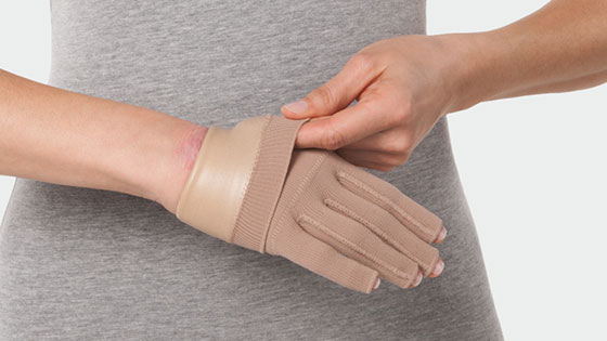 Gloves made from Juzo Silon®-TEX