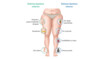 Sintomas gráficos de lipoedema